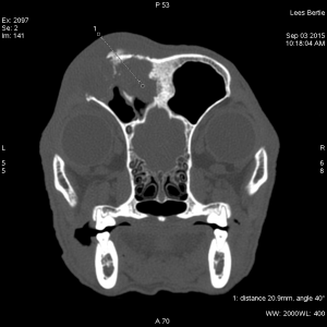 CT OF bERT